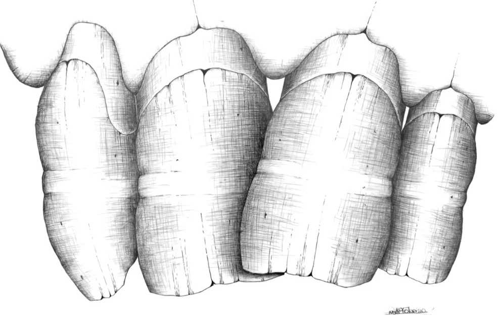 Disegno Ortodontico bianco e nero Fabrizio Anelli