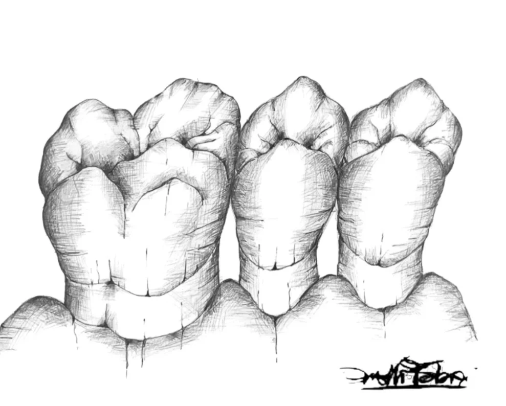 Disegno Ortodontico bianco e nero Fabrizio Anelli