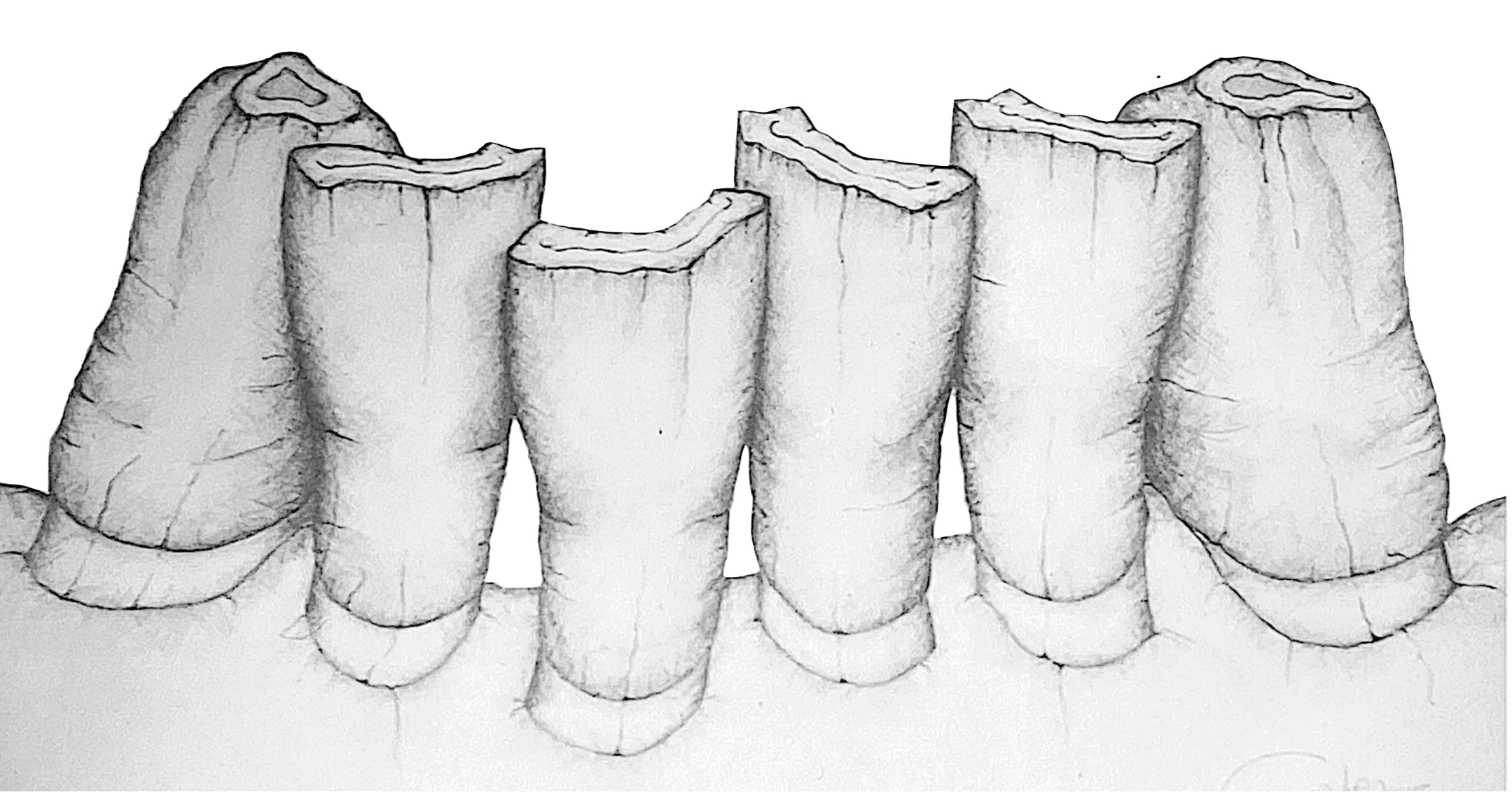 Disegno Ortodontico bianco e nero Fabrizio Anelli