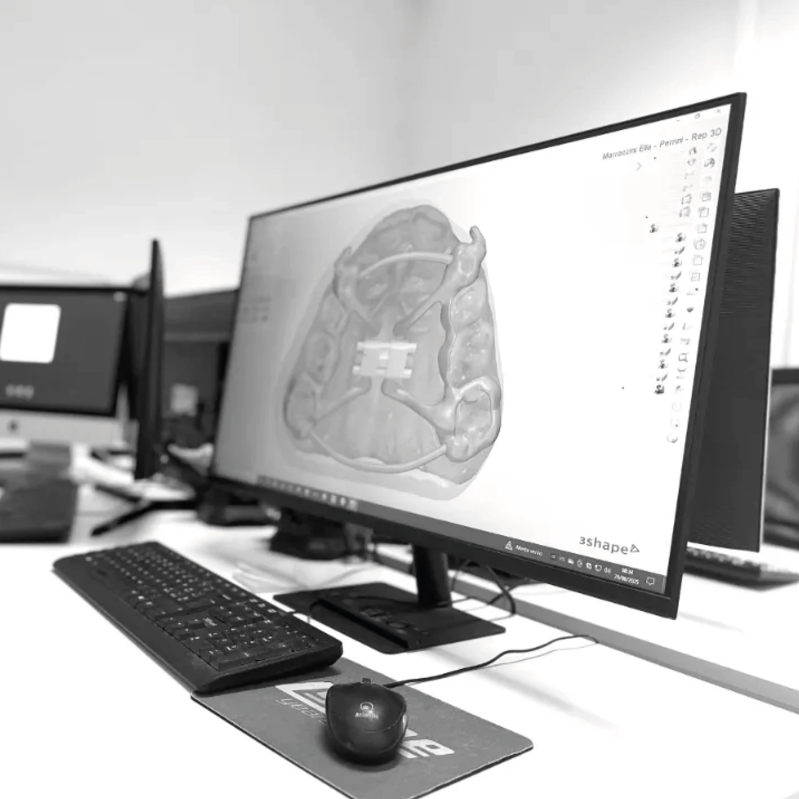 Schermo PC progettazione dispositivi ortodontici - Laboratorio Teor Soluzioni Ortodontiche Rimini