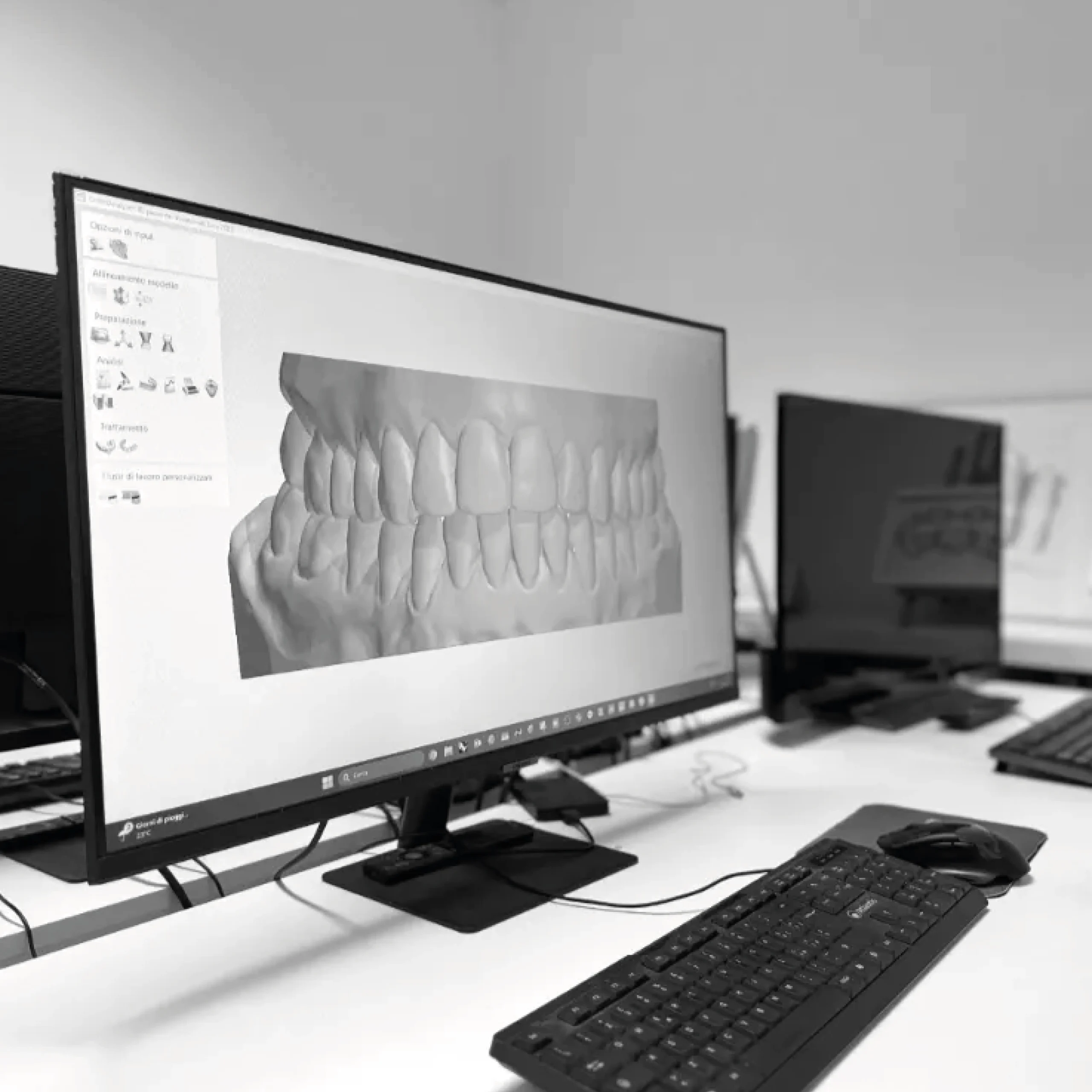 Schermo PC progettazione dispositivi ortodontici - Laboratorio Teor Soluzioni Ortodontiche Rimini